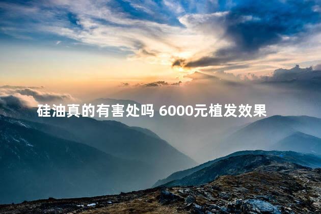 硅油真的有害处吗 6000元植发效果图